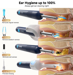 BEBIRD R1 Ultra pinzas diseñadas para extraer cerumen con control suave