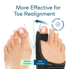 Caretras splint on foot front view illustrating alignment support