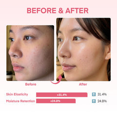 Dongyu YURI mascarilla aplicada en rostro demostrando cubierta uniforme y confort nocturno