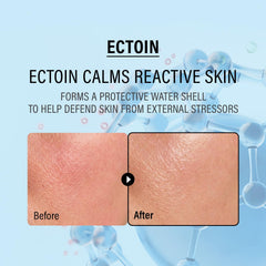epii crema aplicada en mano demostrando absorción rápida
