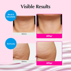 EQQUALBERRY aplicación en cuello para reafirmar y alisar
