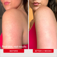 First Aid Beauty applying scrub to arm to show smoothening action and easy spreadability