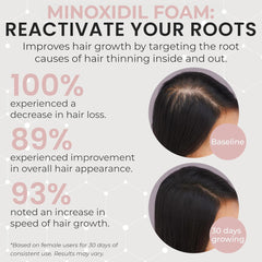 Rida Hair Research Institute textura de la espuma ligera que absorbe rápido