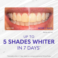 smileactives foaming texture on toothbrush showing even foam coverage
