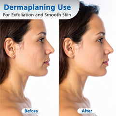 Swann-Morton demostración en mano durante dermaplaning para control óptimo