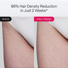 Ulike Air 10 primer plano lente de enfriamiento que reduce la incomodidad