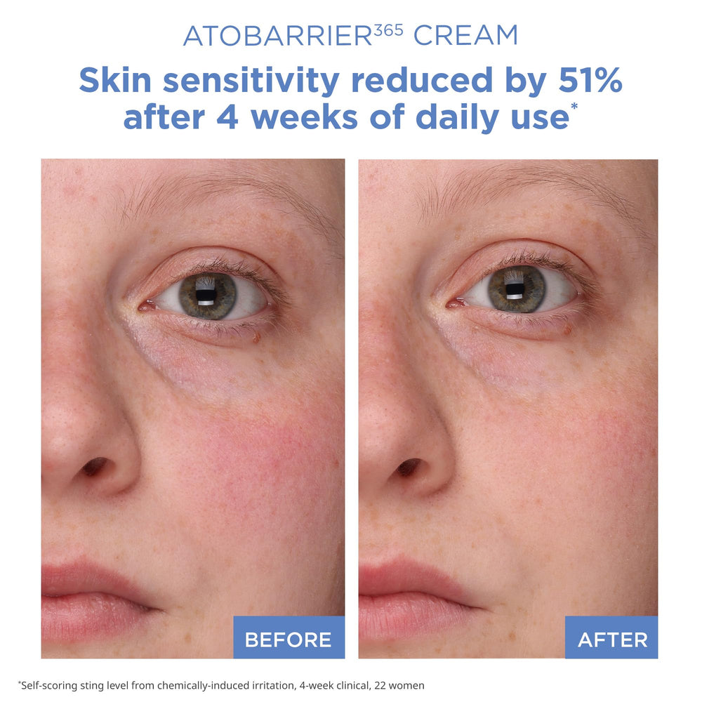 AESTURA cream spread on hand demonstrating lightweight, nourishing feel