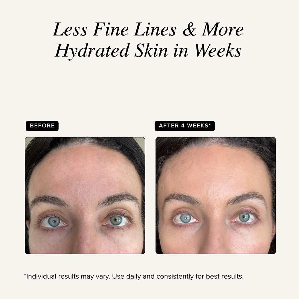 Asterwood aplicando suero en rostro para hidratación inmediata