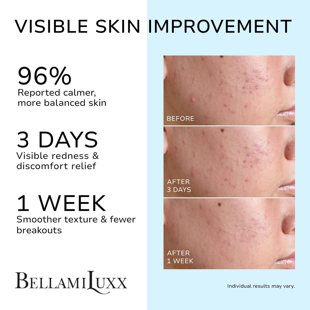 BellamiLuxx textura de crema ligera que hidrata sin obstruir poros