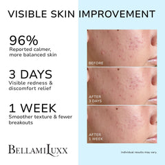 BellamiLuxx textura de crema ligera que hidrata sin obstruir poros