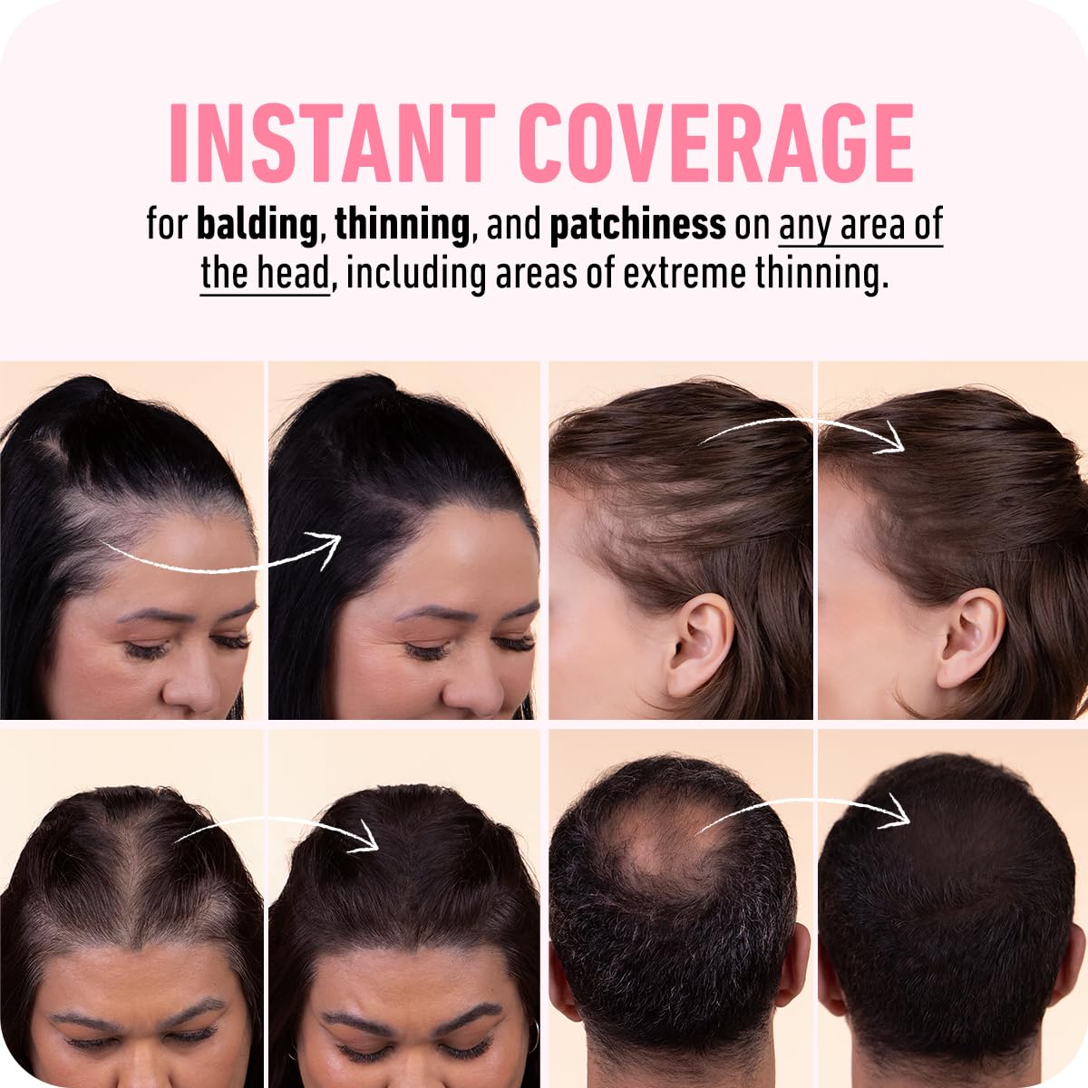 Boldify producto en uso en línea frontal para aspecto natural y confianza inmediata