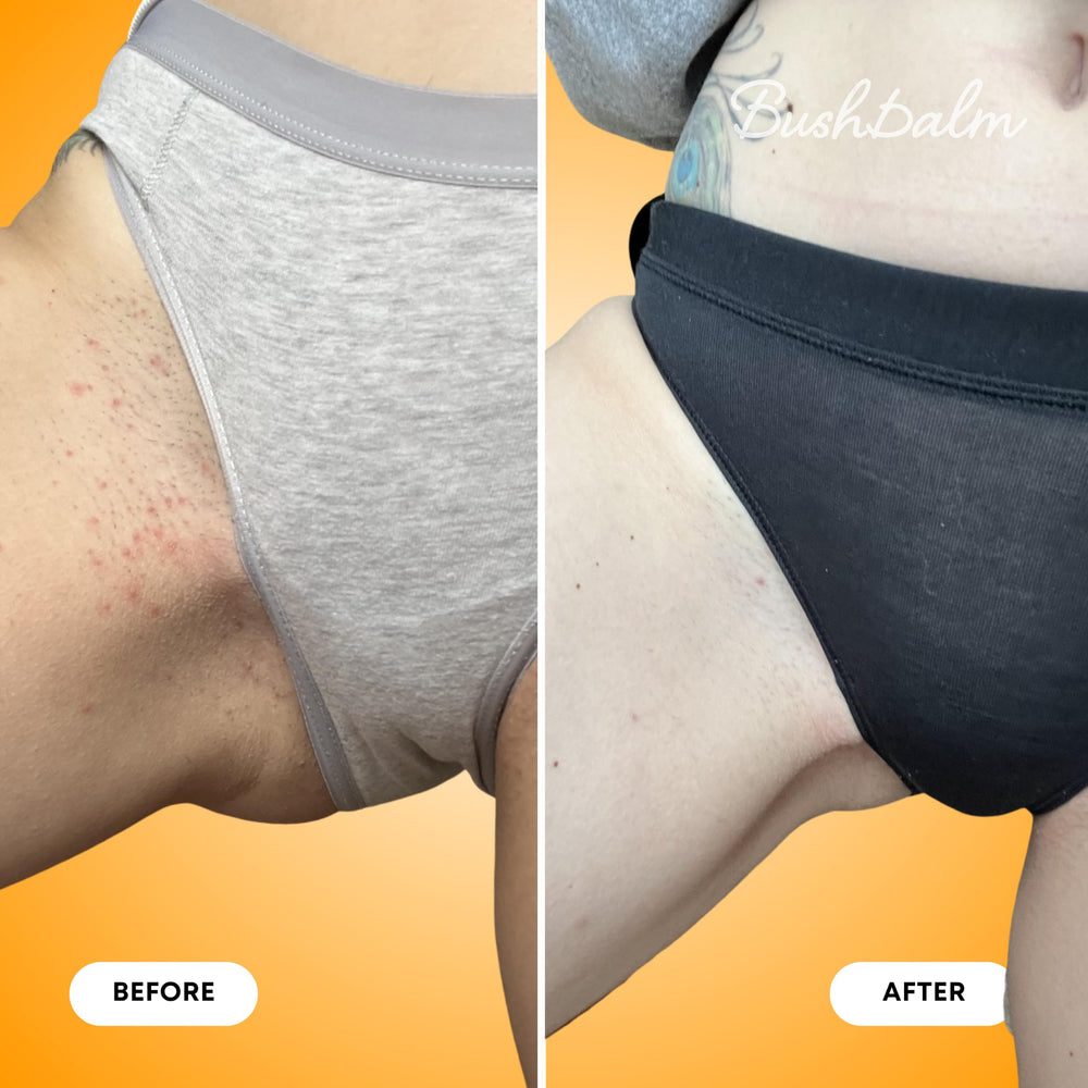 Etiqueta Bushbalm con lista de ingredientes naturales y beneficios visibles