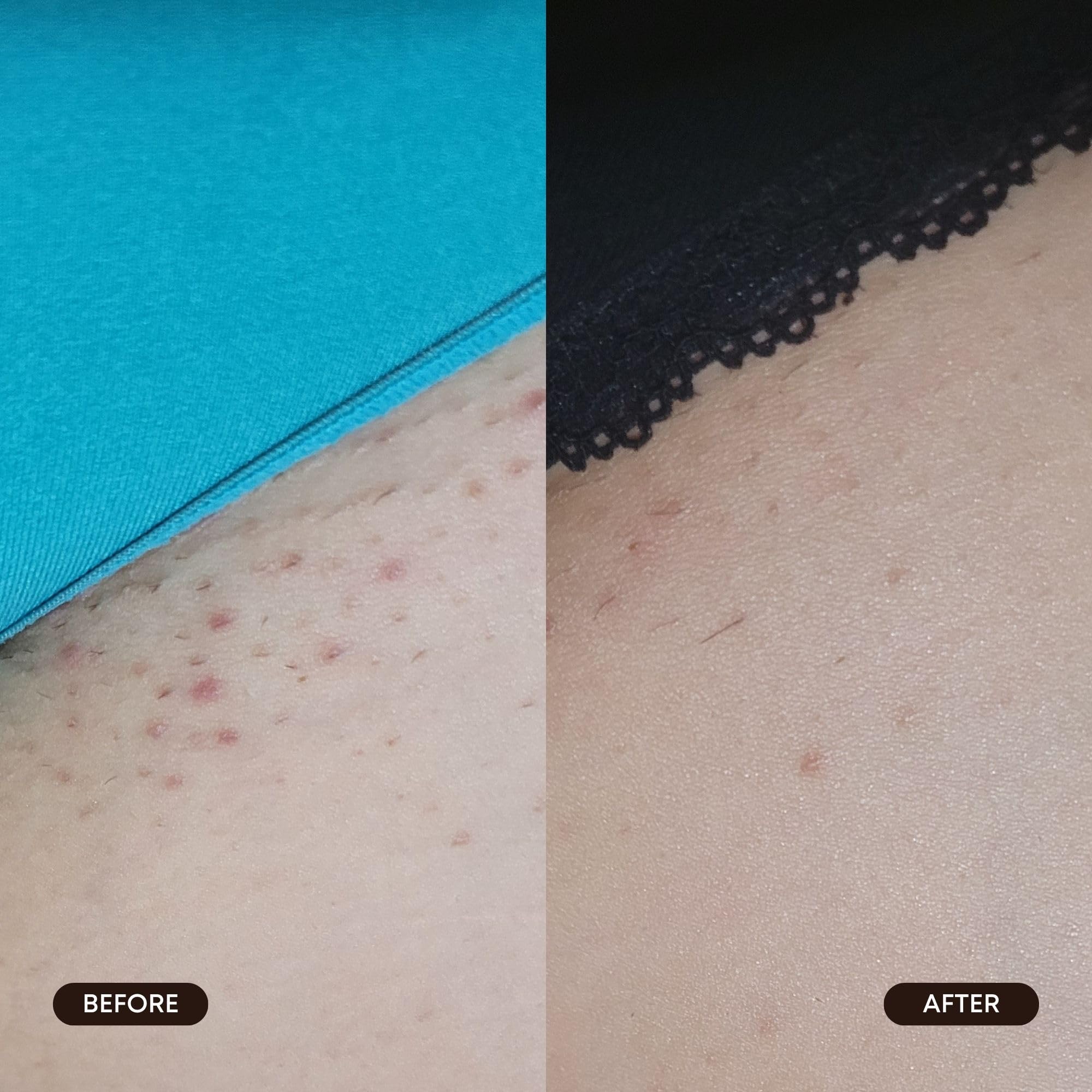 Etiqueta de Bushbalm con lista de ingredientes clave y beneficio calmante