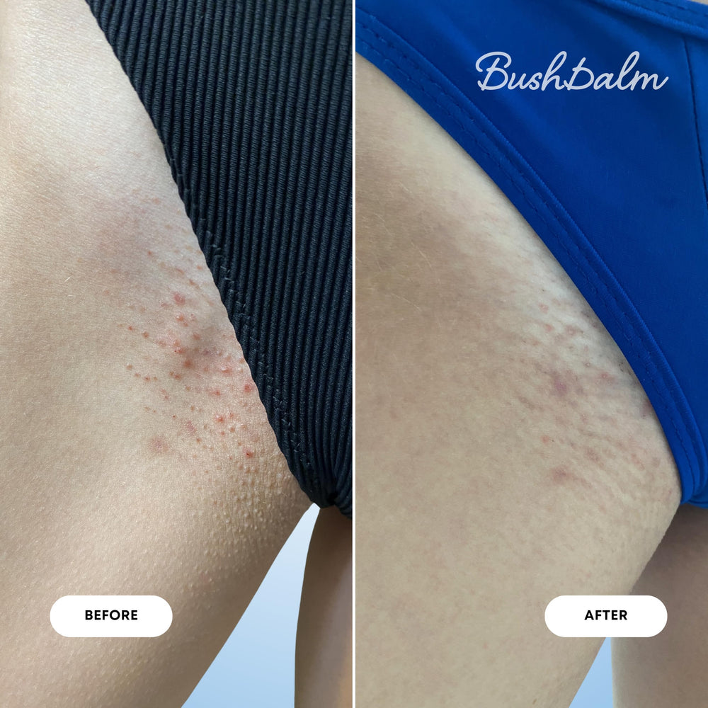 Bushbalm productos junto a una regla para mostrar tamaño real
