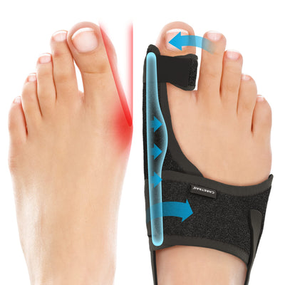Caretras front packaging showing two bunion correctors and benefits