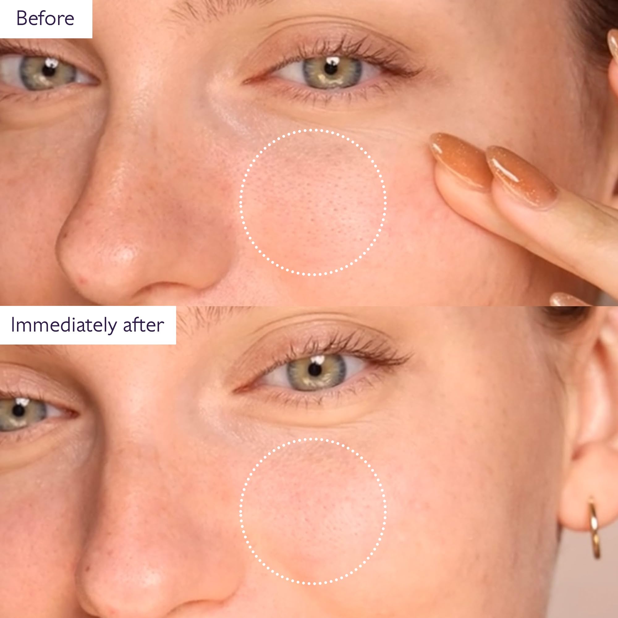 Caudalie mascarilla aplicada en rostro demostrando efecto purificante
