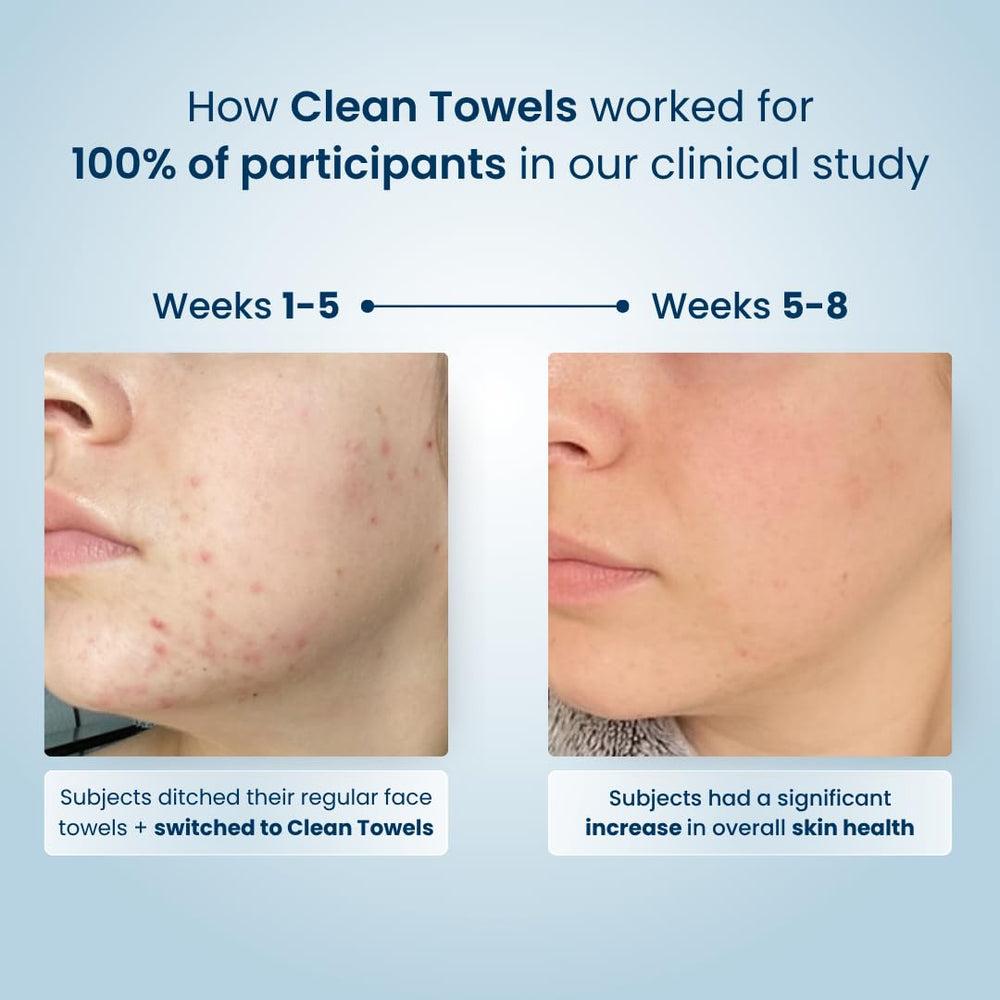 CLEAN SKIN CLUB toallita dentro de un neceser, ideal para viajes