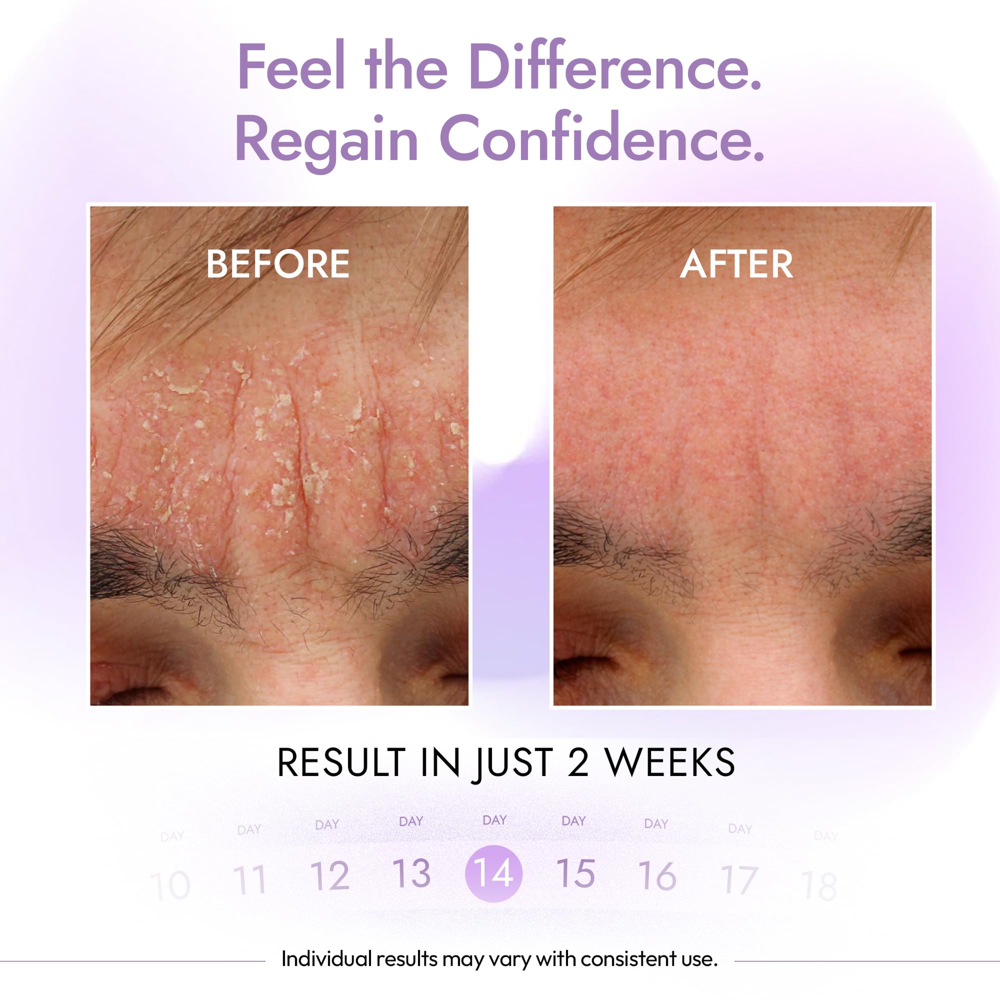DERMAdoctor comparación de tamaño 7.1 fl oz junto a elementos cotidianos