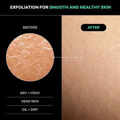 Dermasuri demostración de uso en ducha con correas, alcance cómodo