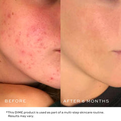 DIME gel desmaquillando rostro mostrando limpieza eficaz sin frotar