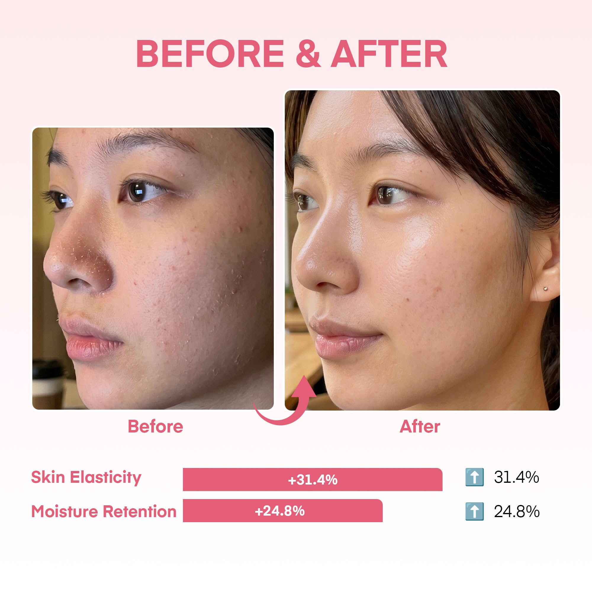 Dongyu YURI mascarilla aplicada en rostro demostrando cubierta uniforme y confort nocturno