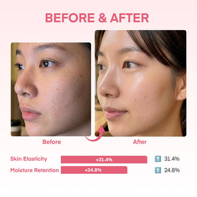 Dongyu YURI mascarilla aplicada en rostro demostrando cubierta uniforme y confort nocturno