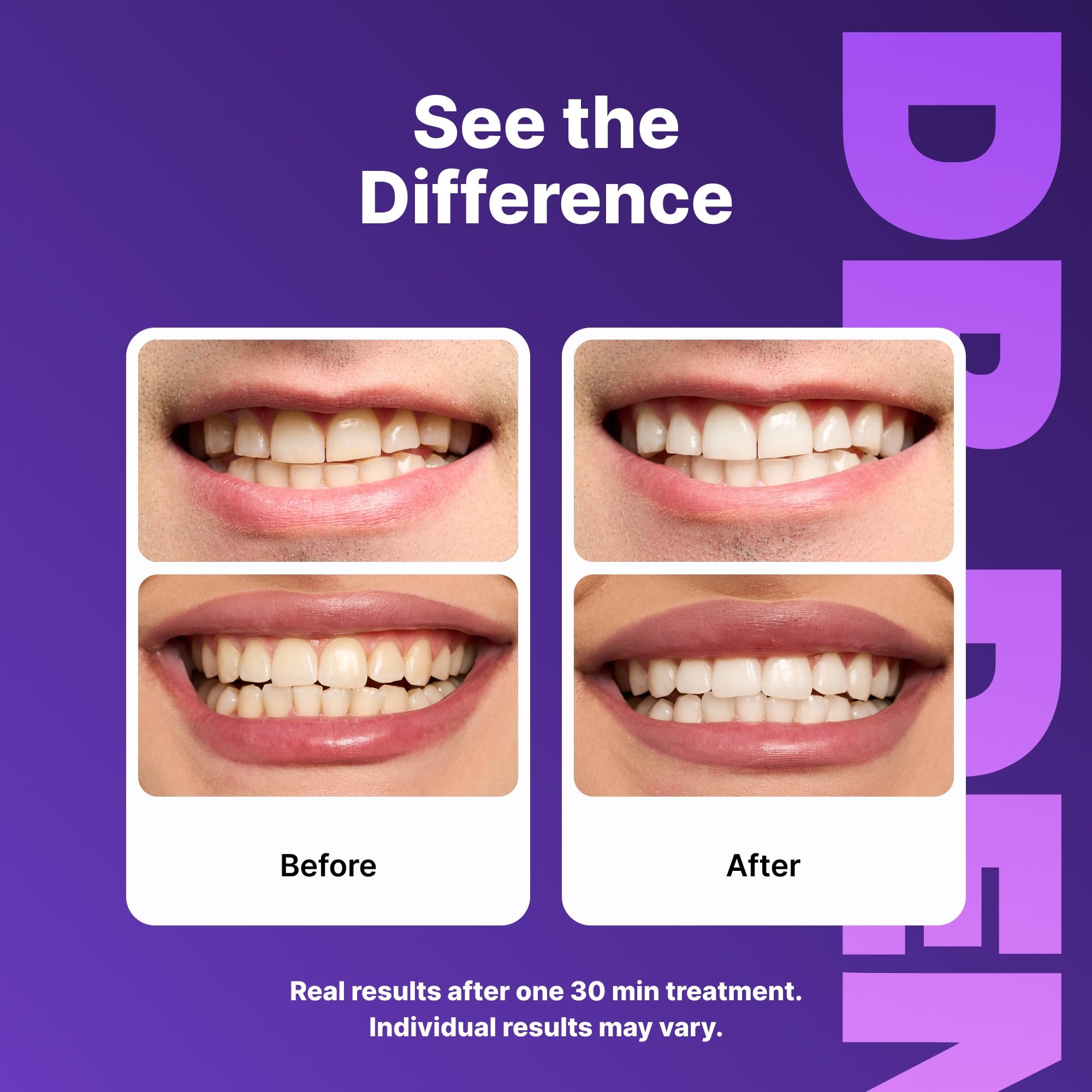 DrDent primer plano de textura de la tira mostrando adherencia cómoda