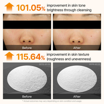 Dr.Melaxin before and after swipe comparison showing brighter skin benefit