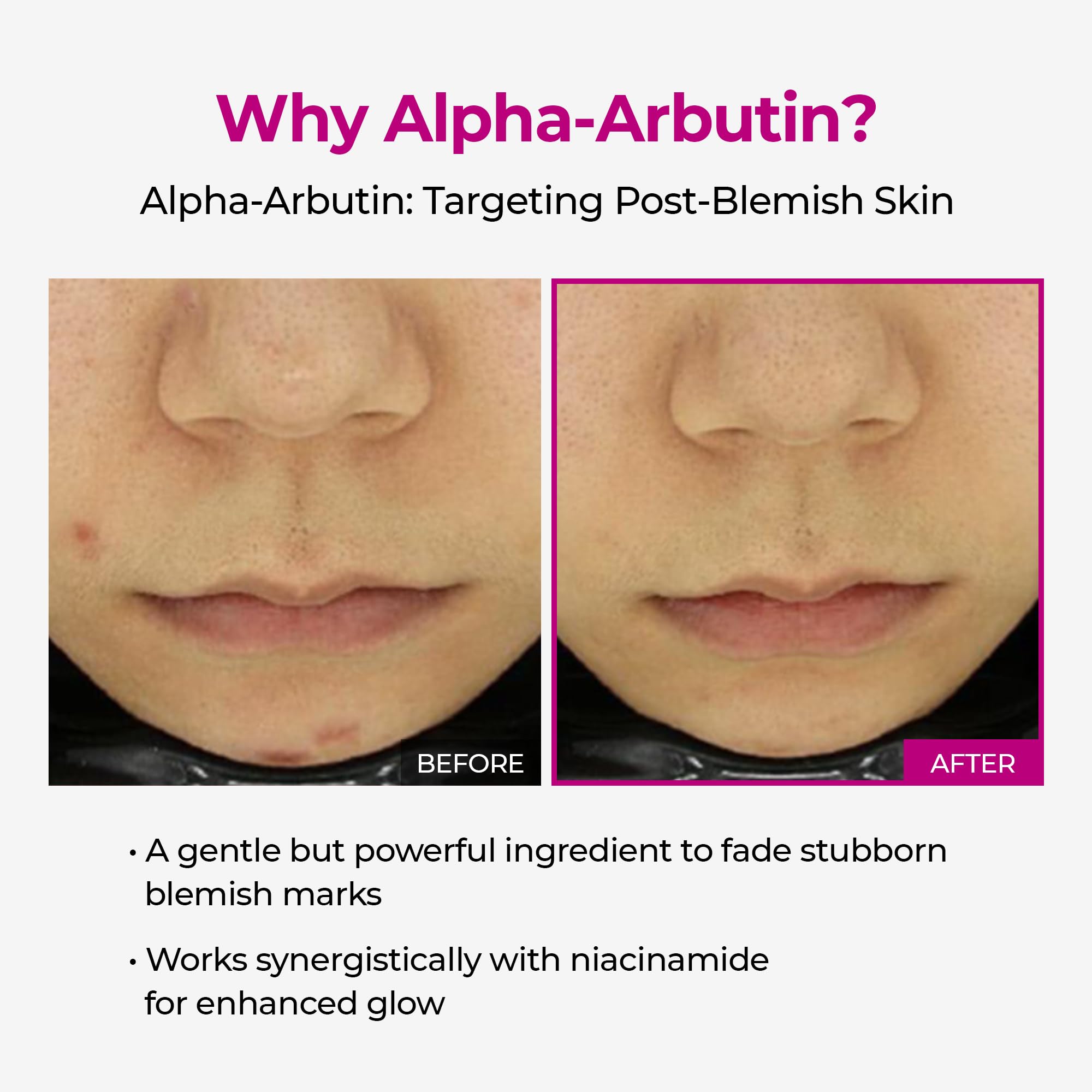 Dr.Melaxin etiqueta con ingredientes clave para reducir manchas