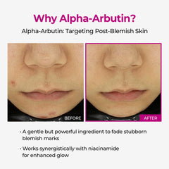 Dr.Melaxin etiqueta con ingredientes clave para reducir manchas