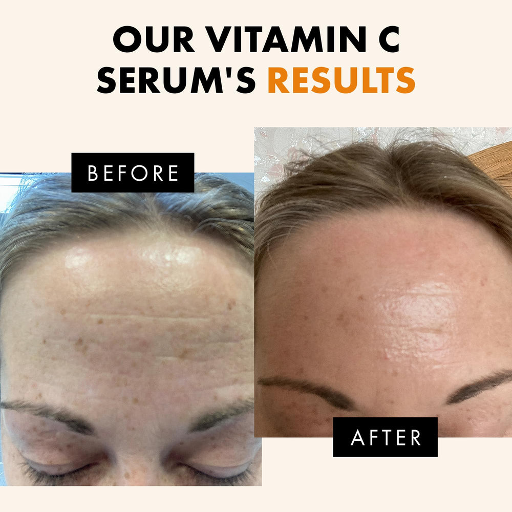 Eclat Skincare aplicación en mano demostrando fácil absorción y sensación ligera