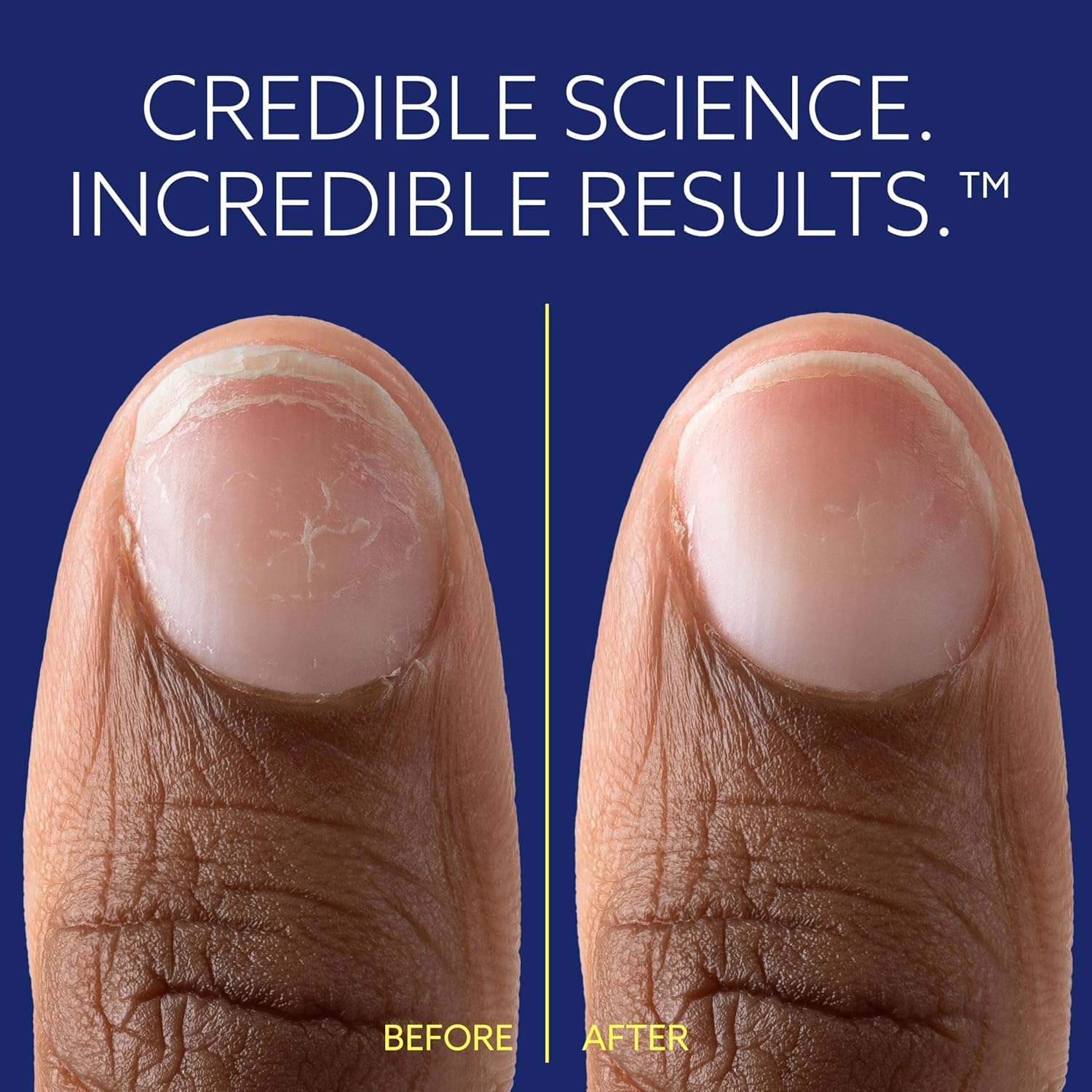 epres ePhD comparación antes y después con uñas más fuertes y lisas