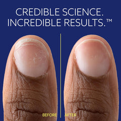 epres ePhD comparación antes y después con uñas más fuertes y lisas