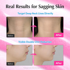 EQQUALBERRY aplicación en rostro y cuello para firmeza y suavidad