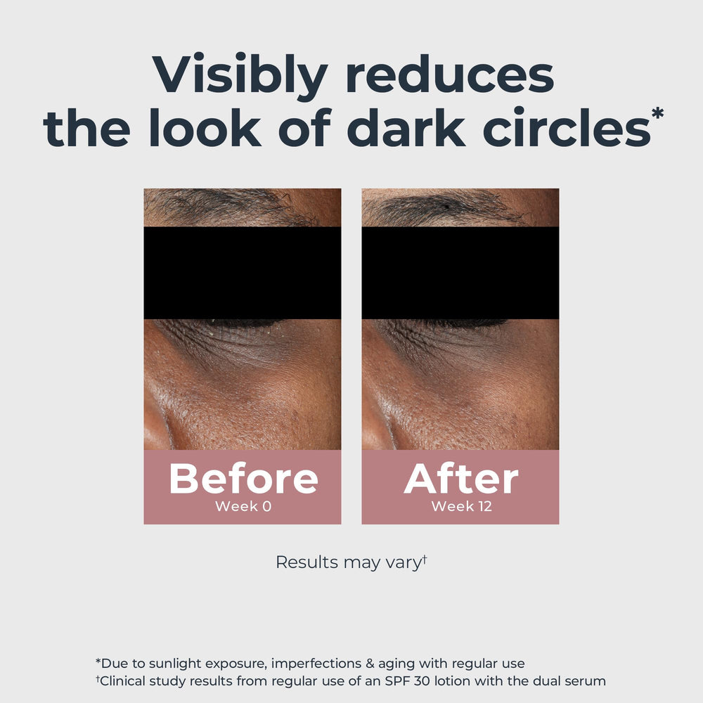Eucerin aplicación en piel bajo ojo para reducir ojeras visualmente