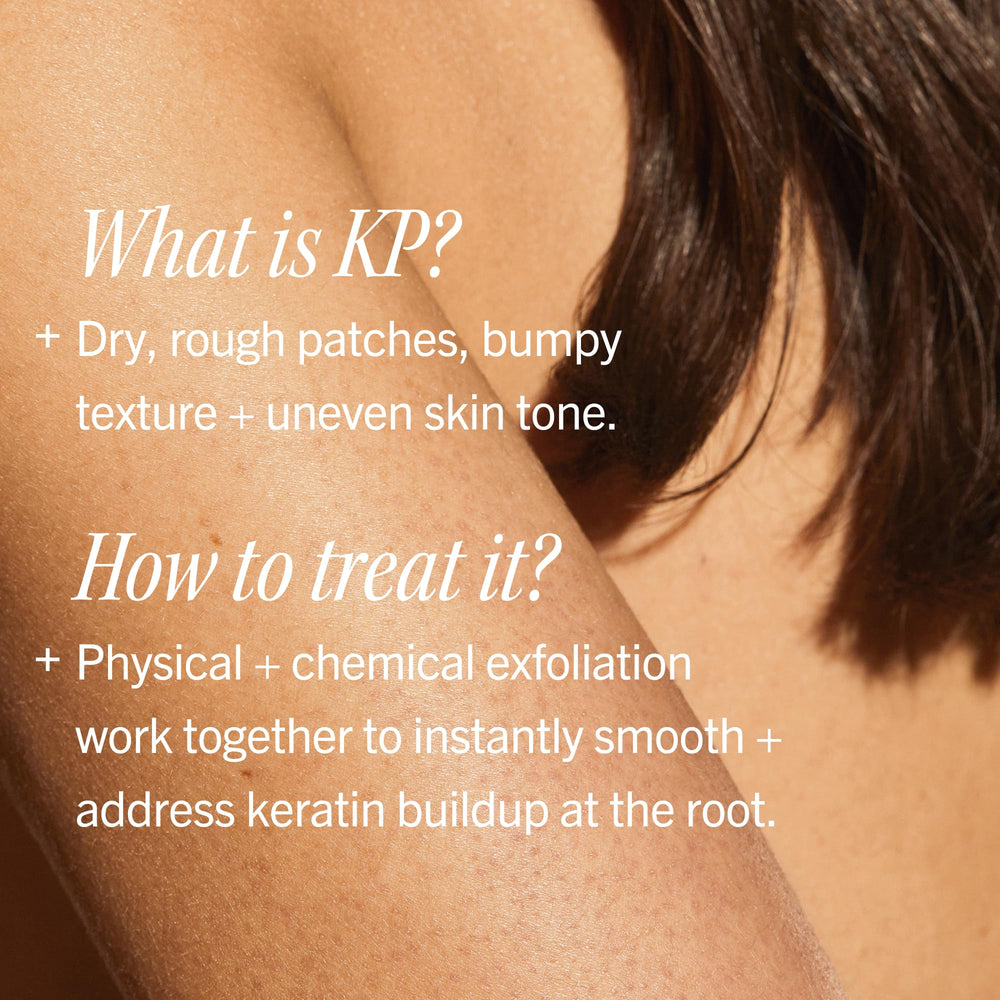 First Aid Beauty before and after legs demonstrating reduced flakiness and improved texture