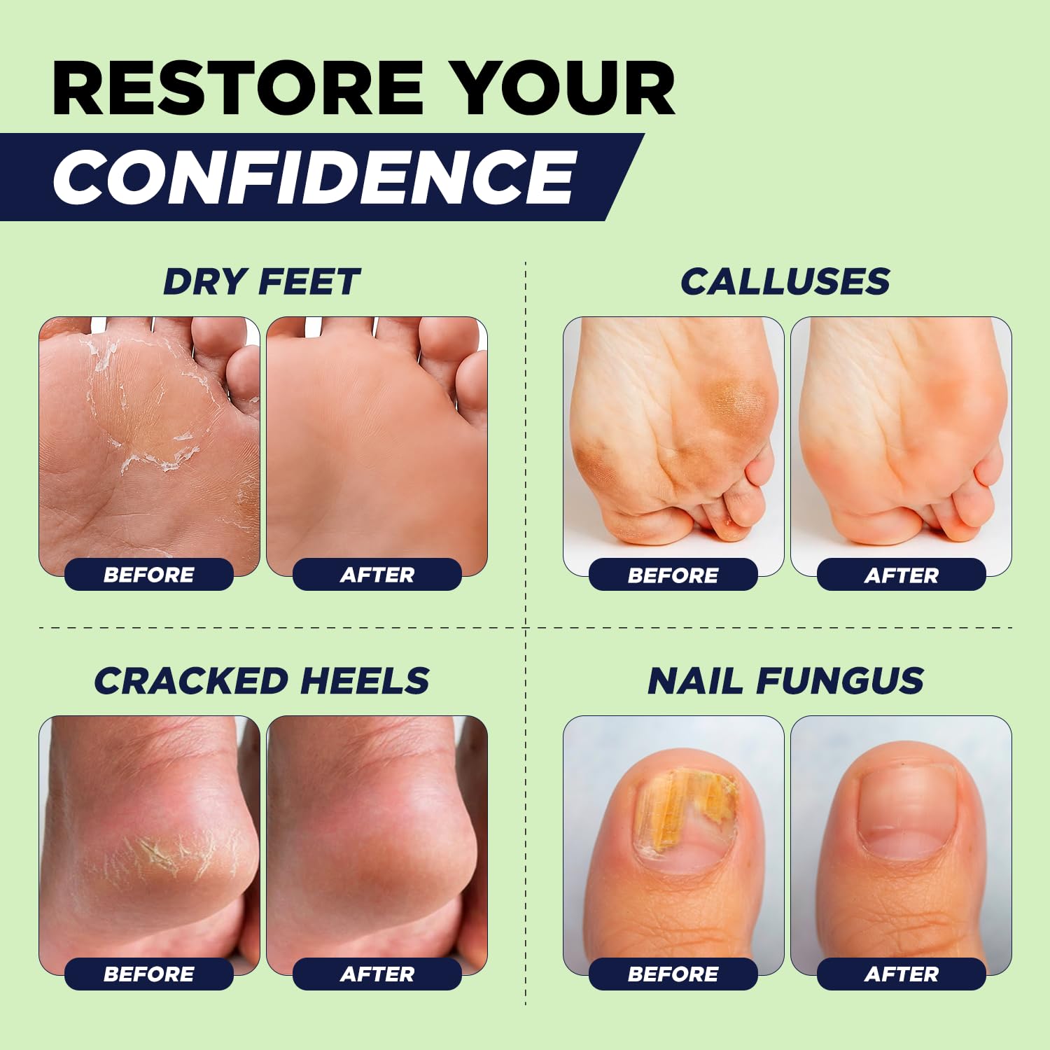 FOOT CURE envase comparado con mano para apreciar tamaño y uso