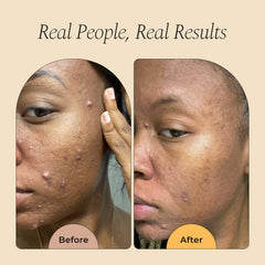 Glo Melanin aplicador scrub integrado que exfolia suavemente durante la limpieza