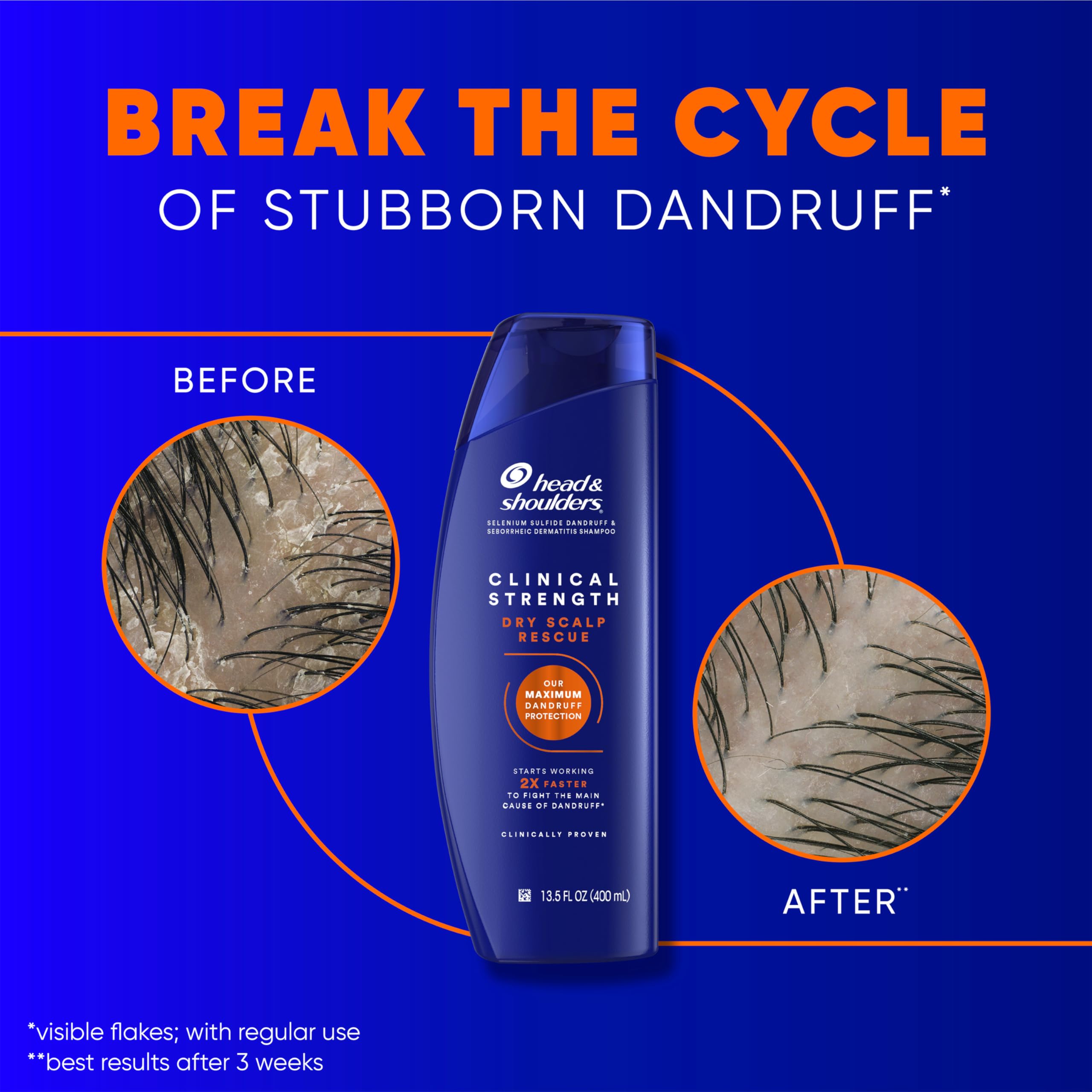 Head & Shoulders primer plano de la etiqueta indicando 1% selenium sulfide como ventaja activa