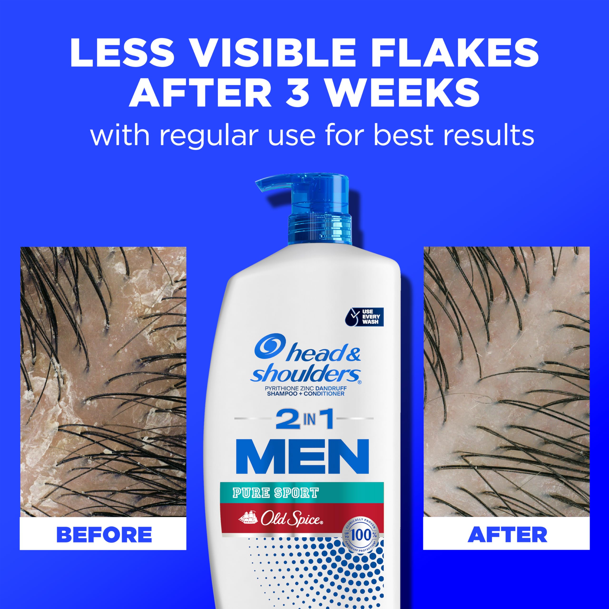 Head & Shoulders uso en la ducha con espuma, rutina diaria rápida y efectiva