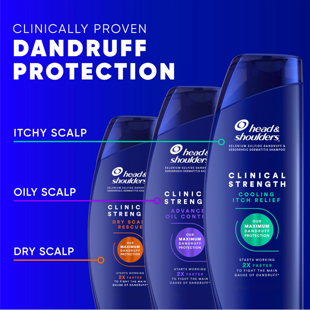 Head & Shoulders espuma en la palma mostrando textura rica y resultado acondicionador