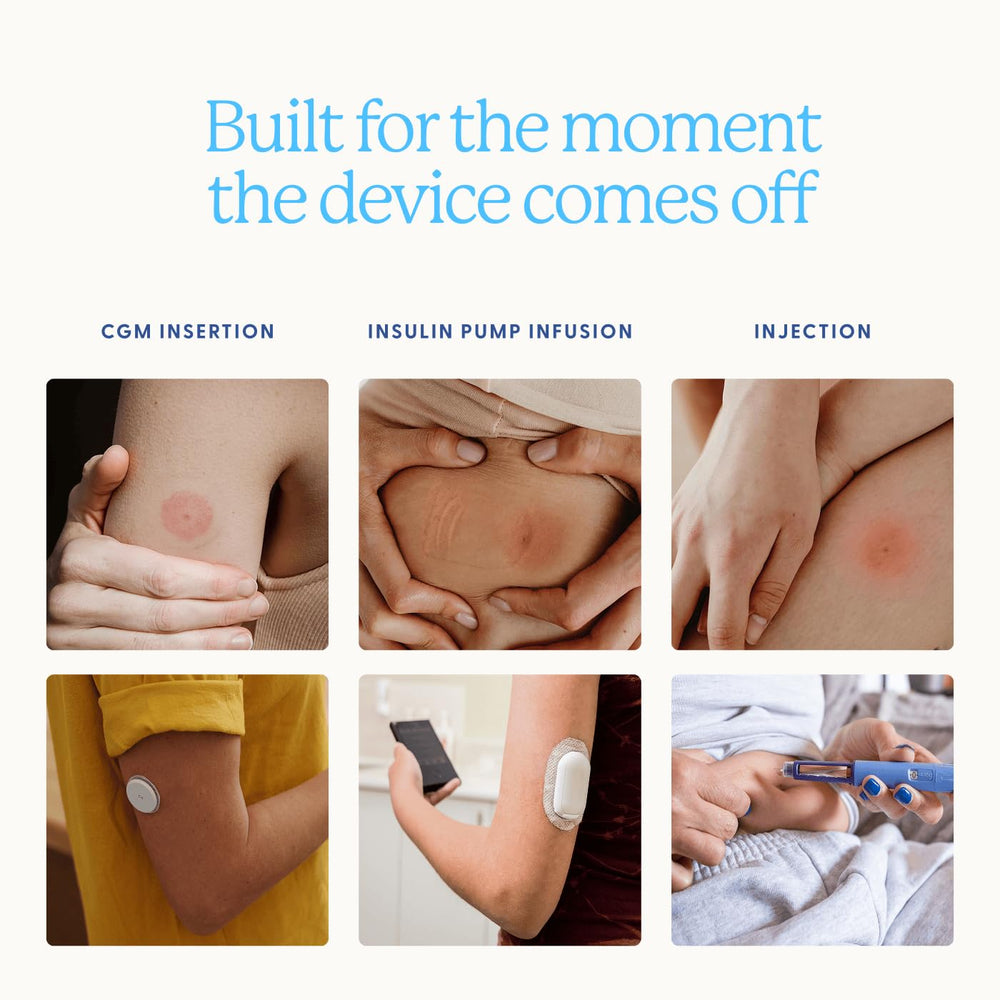 Healthy Sites parche aplicado en el brazo demostrando uso tras retirar un sensor