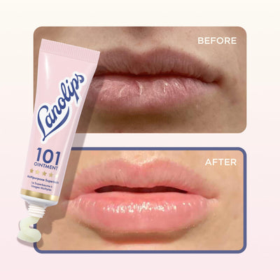 Lanolips aplicación en codo reseco mostrando mejora de textura