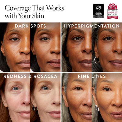 LAURA GELLER side-by-side before and after showing reduced redness and even tone