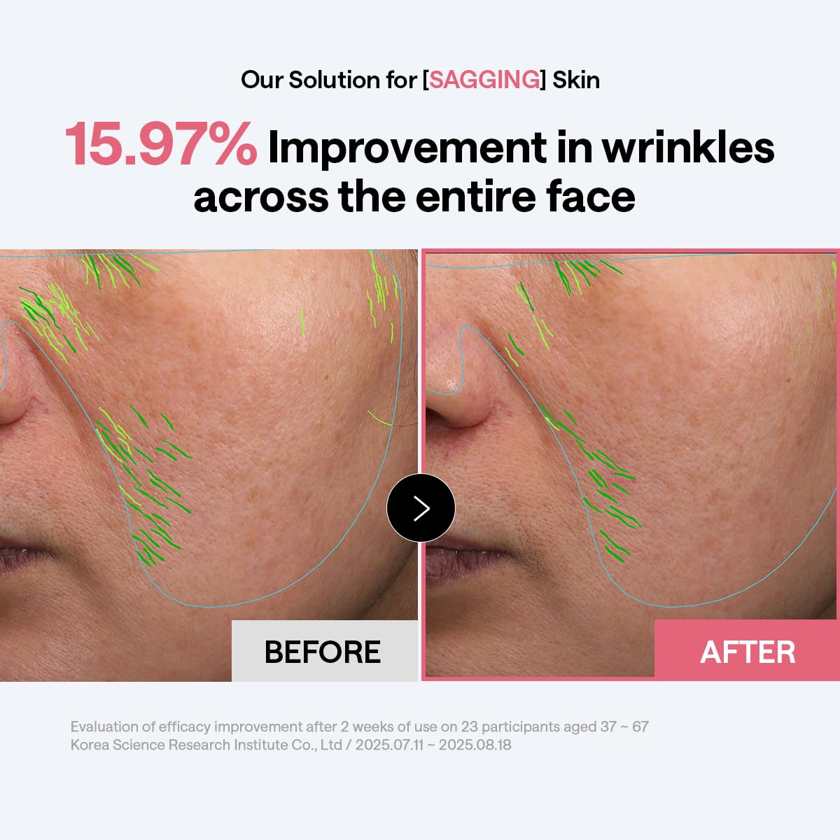 MEDIHEAL pads colocados como mascarilla localizada para reafirmar zonas