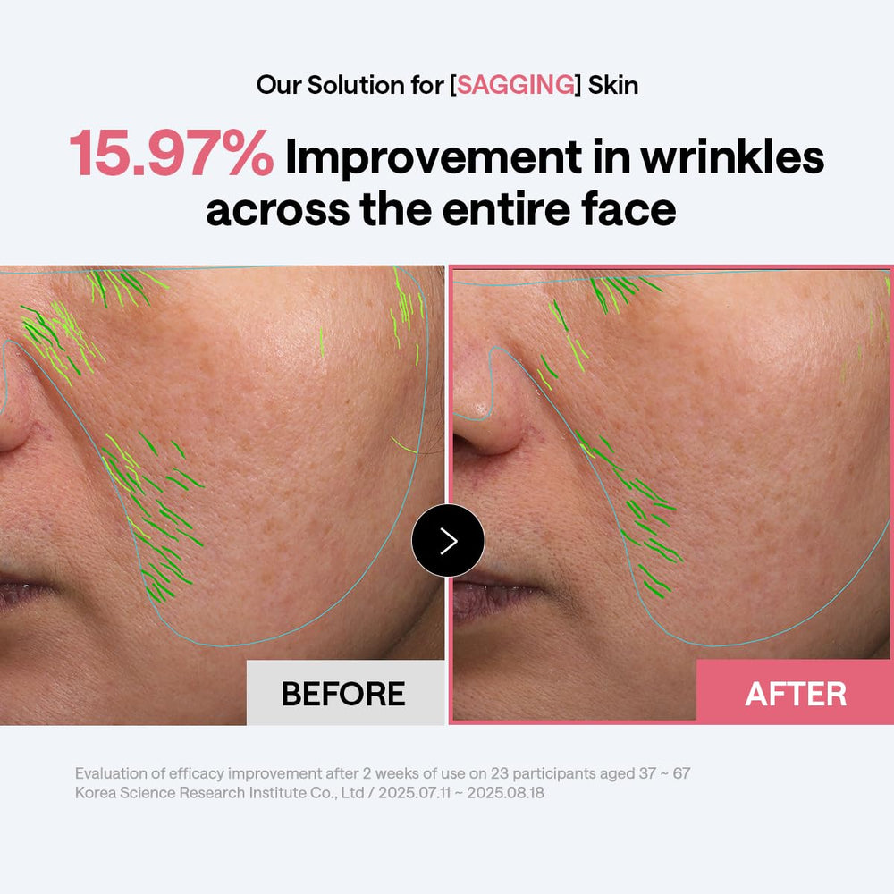 MEDIHEAL pads colocados como mascarilla localizada para reafirmar zonas