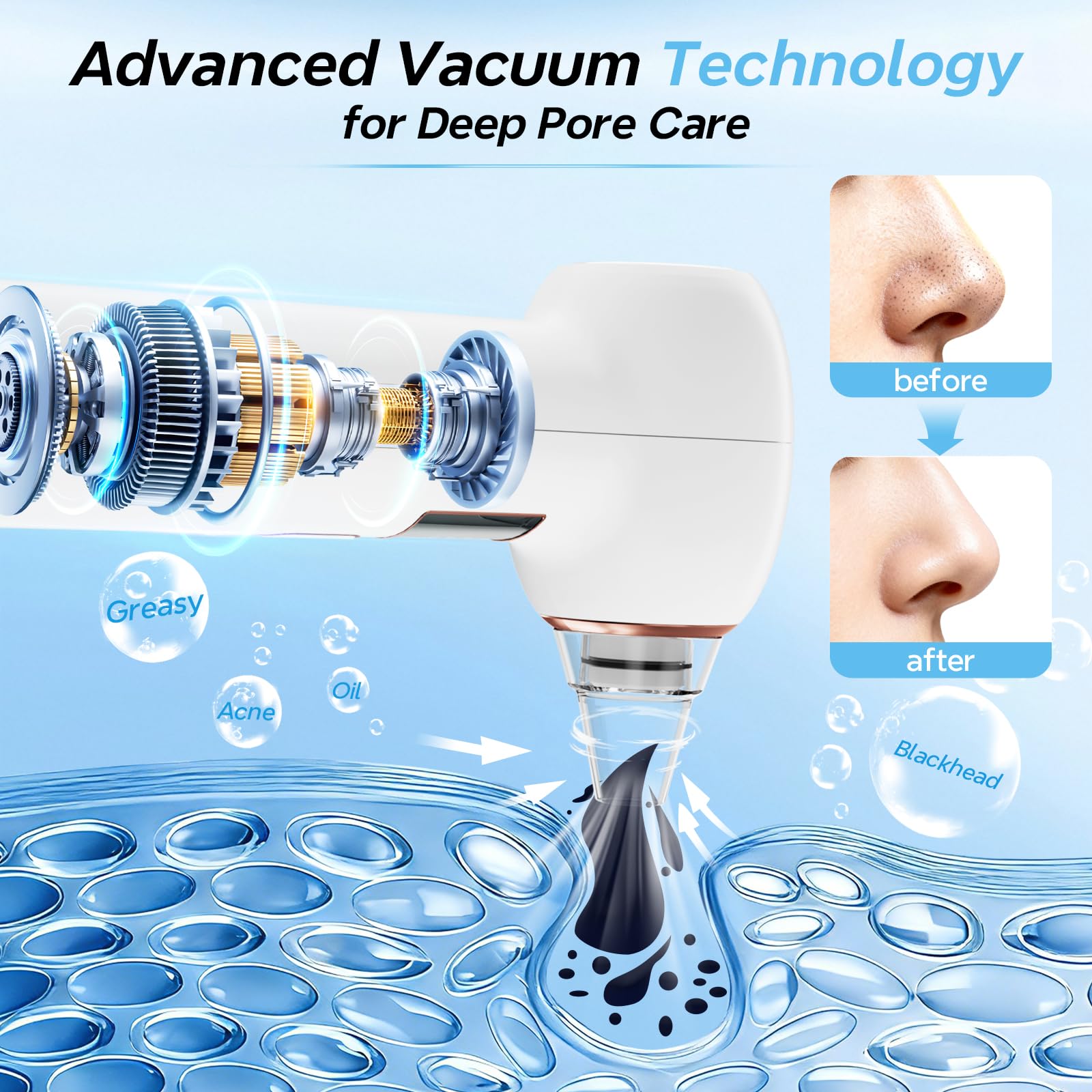 Mylzdobs five interchangeable probes and accessories arranged for targeted care benefit