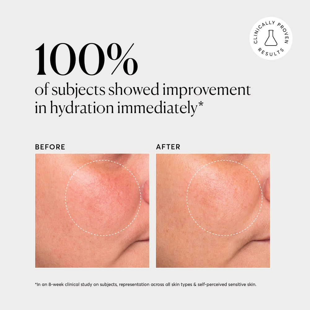 Naturium cream applied to cheek to show smooth application and glow