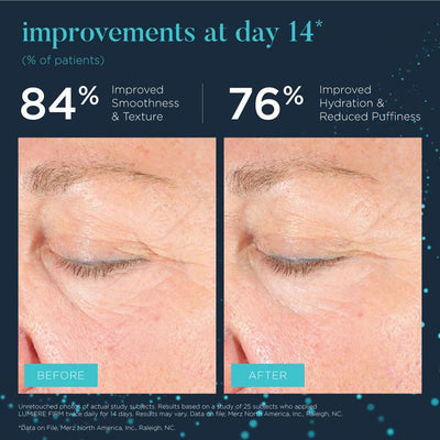NEOCUTIS before and after comparison demonstrating improved eye radiance
