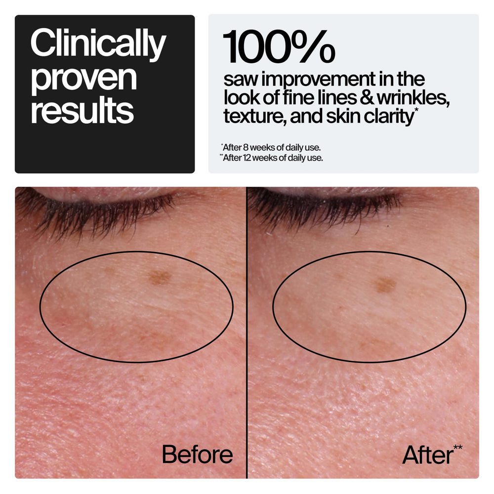 Neutrogena detalle de etiqueta con información de retinol y beneficios claros